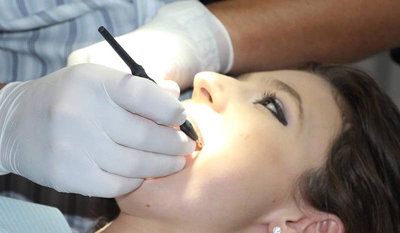 benefits of teeth cleaning and polishing