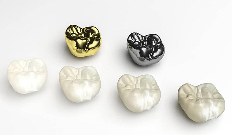 how to take care of new dental crowns