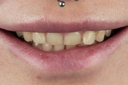 Adsız tasarım – 1 Adsız tasarım - 1