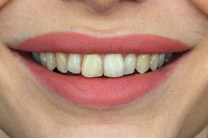 Adsız tasarım – 9 Adsız tasarım - 9