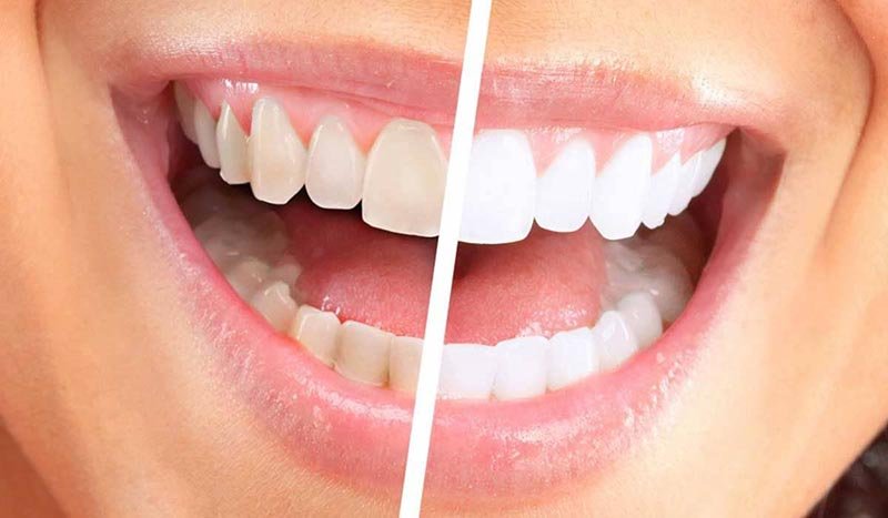 how to brush your teeth in the right way