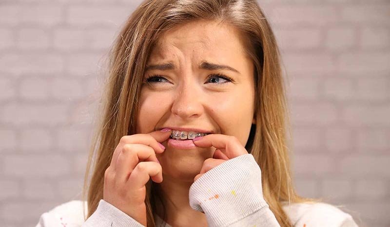 how to take care of braces