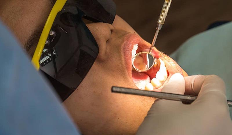 is the teeth whitening safe