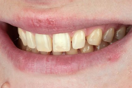 Adsız tasarım – 1 Adsız tasarım - 1