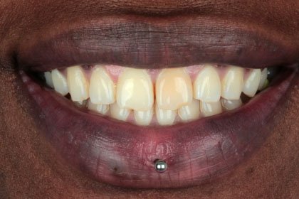 Adsız tasarım – 1 Adsız tasarım - 1