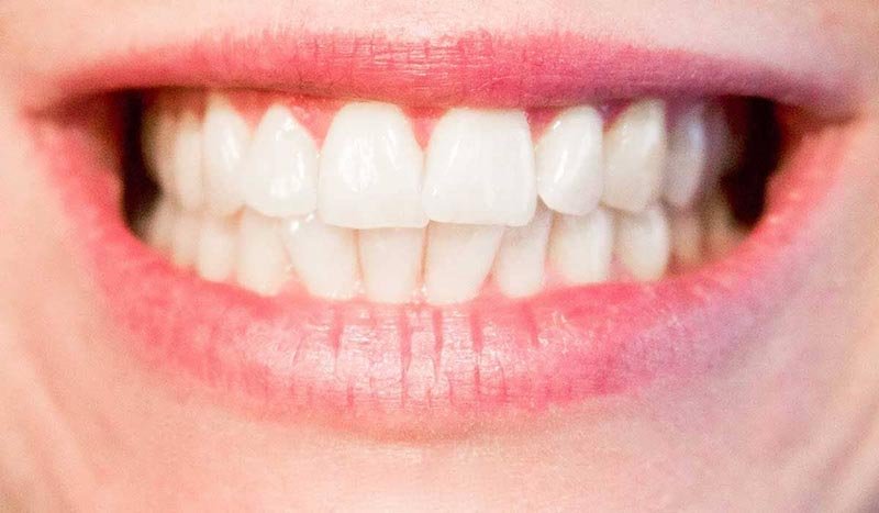 tips to prevent tartar