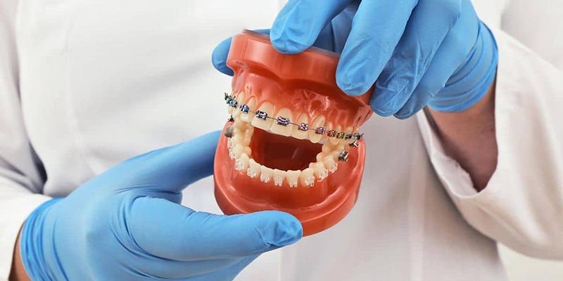 will there be problems after getting dentures