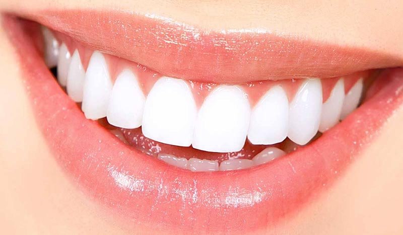 zoom teeth whitening